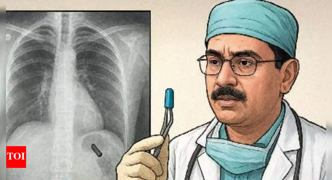 <div>Pen cap stuck in lung for 26 yrs: Delhi doctors remove object; express shock at 'rare case'</div>