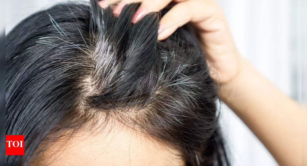 Why some people never get grey hair: Health secrets behind youthful strands