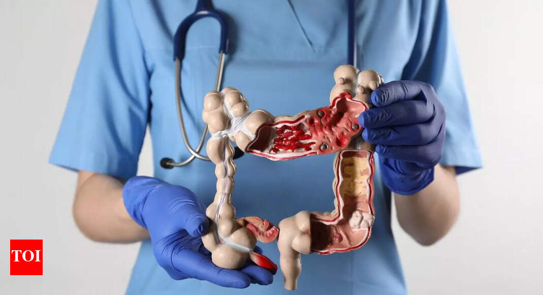​8 deadly colon cancer signs that should not be ignored, according to a top gastroenterologist | – The Times of India