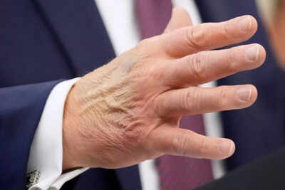 Trump dismisses health rumors as ‘fake news,’ but ‘two-tone hands’ and late arrival re-spark Oval Office gossip