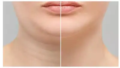 இதய ஆரோக்கியத்திலிருந்து நீரிழிவு ஆபத்து வரை: ஒருவரின் ஒட்டுமொத்த ஆரோக்கியத்தைப் பற்றி கழுத்து அளவு வெளிப்படுத்துகிறது