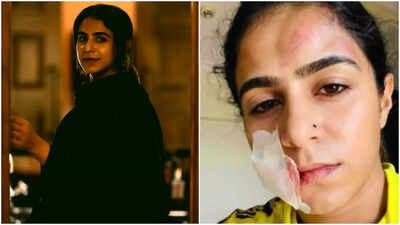 Malayalam TV actress Jaseela Parveen alleges physical abuse by her ex-boyfriend, says, ‘He kicked me on the stomach, punched my face causing a facial tear'