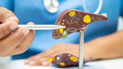 Gastroenterólogo formado en Harvard revela 3 alimentos que ayudan a reducir la grasa del hígado y favorecen la desintoxicación