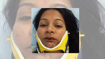 Indian-origin couple's story of being punched, kicked by Chinese man at Switzerland hotel goes viral