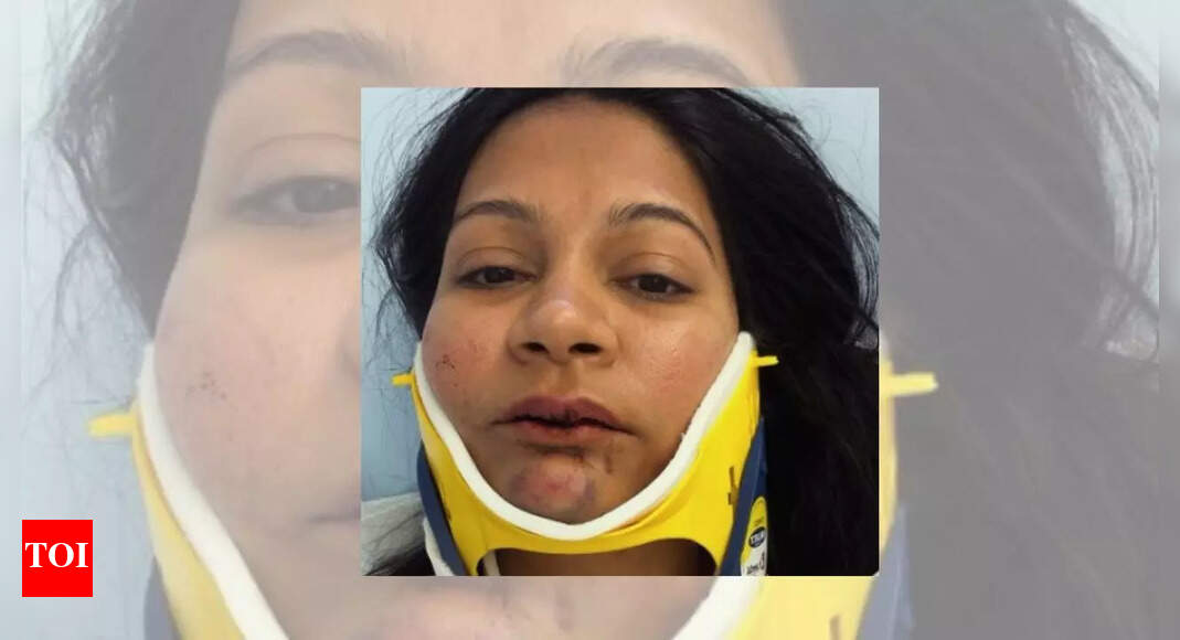 <div>I dont feel like myself anymore: Indian-origin couples story of being punched, kicked by Chinese man at Switzerland hotel goes viral</div> <div>'I don't feel like myself anymore': Indian-origin couple's story of being punched, kicked by Chinese man at Switzerland hotel goes viral</div>