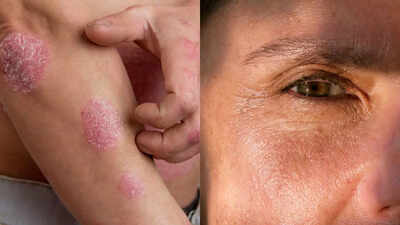  16 side effects and risks you should know