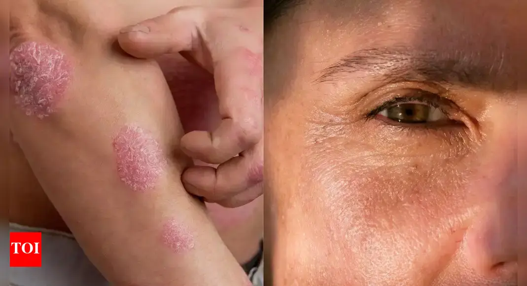 How smoking affects the skin: 16 side effects and risks you should know