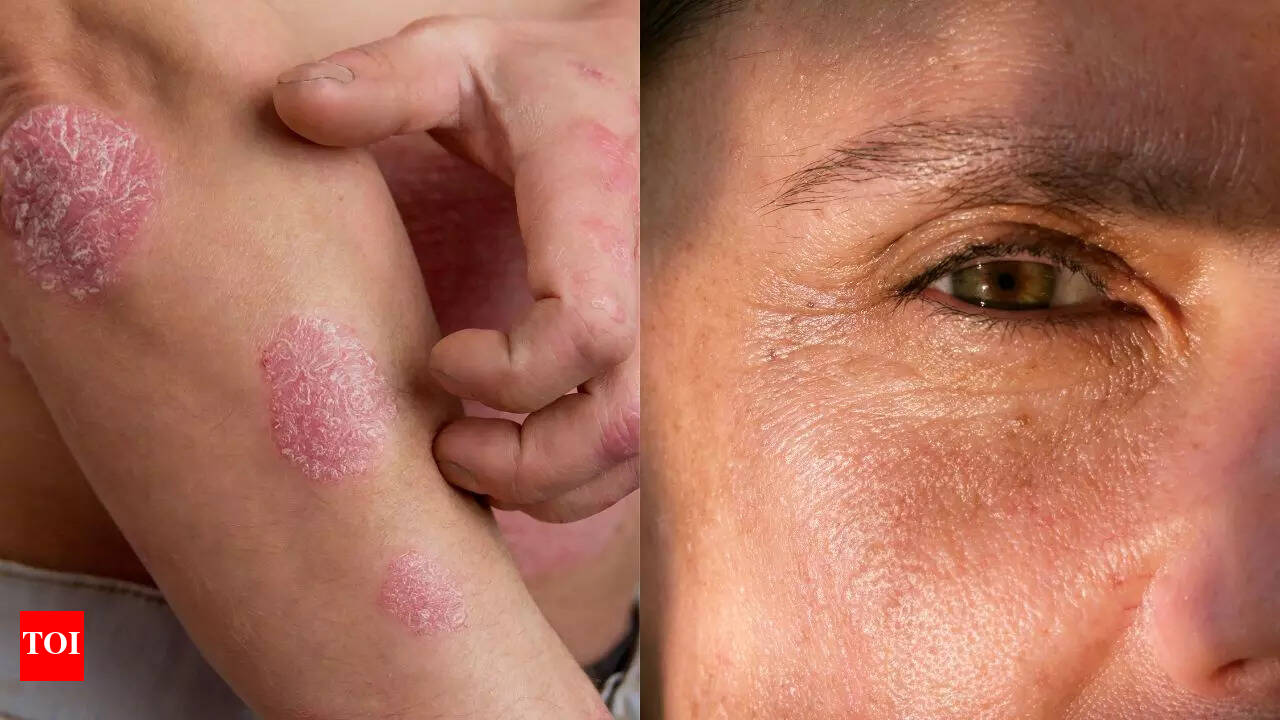 cigarettes patches side effects How smoking affects the skin: 16 side effects and risks you should know