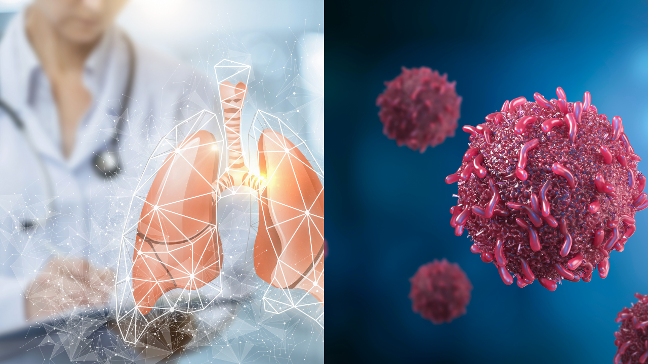 Lancet warns: While chronic disease deaths drop globally, India sees uptick  in Cancer, Diabetes, and Heart Disease | - The Times of India