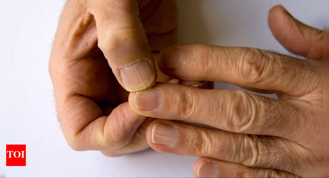 7 changes in nails that could indicate serious health issues