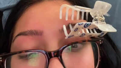  Does putting a claw clip on the eyebrow really help with migraines?