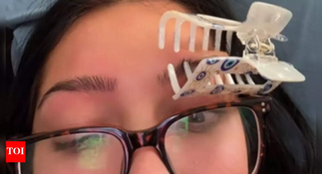 Fact check: Does putting a claw clip on the eyebrow really help with migraines?
