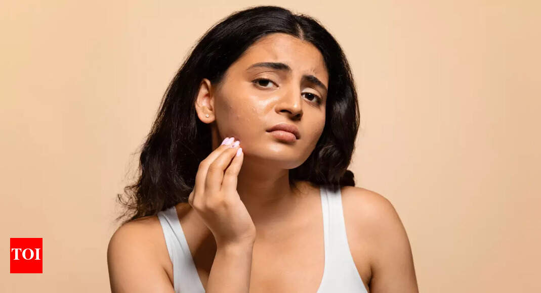 Top tips to combat dry skin and breakouts during seasonal changes