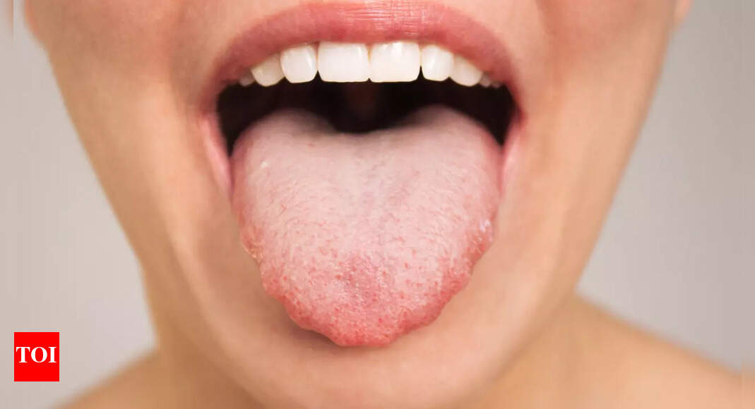 What your tongue says about your heart health