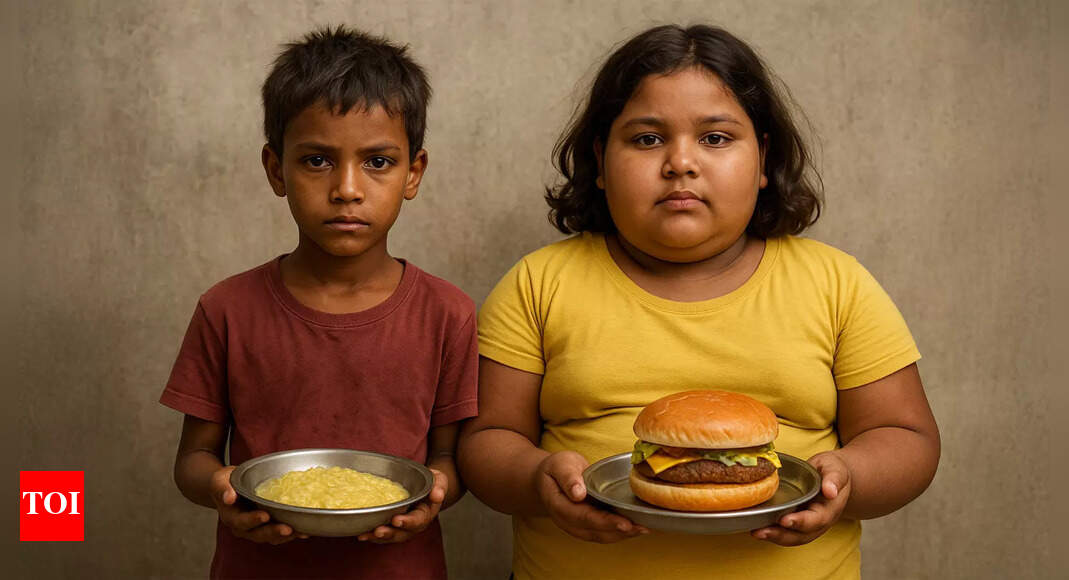More kids are obese than hungry for the first time ever