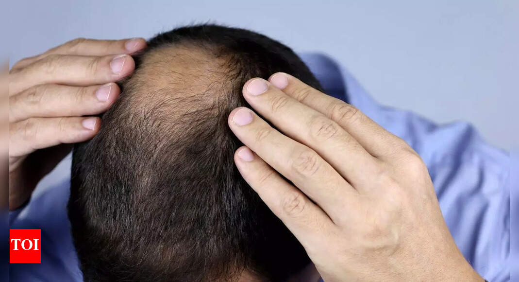 Do hair loss medications affect male fertility? Risks and safer alternatives for men