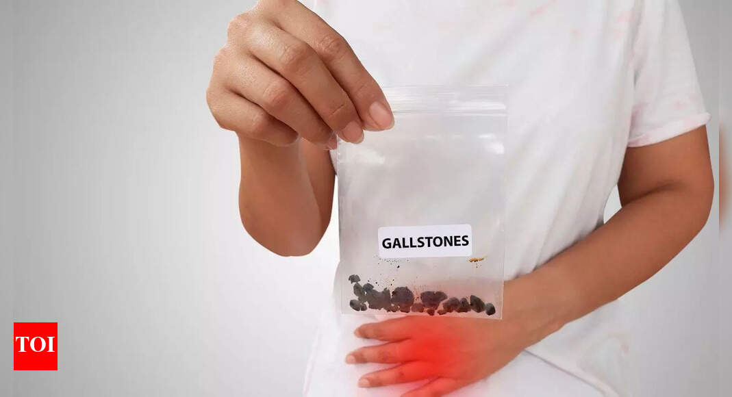 What are gallstones: How they may increase the risk of gallbladder cancer