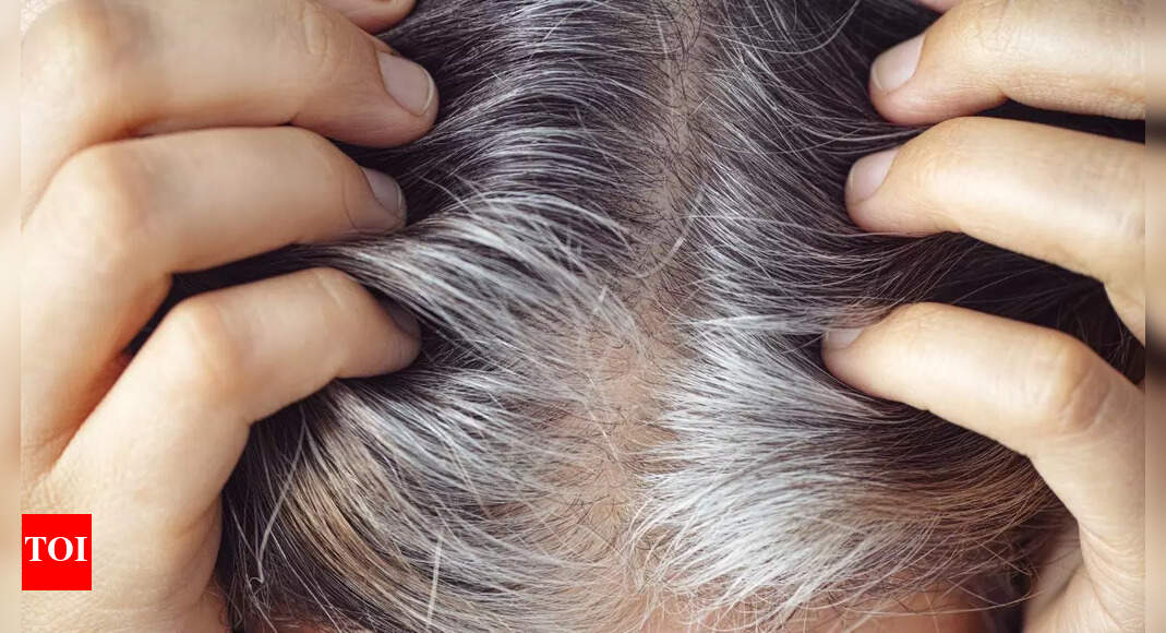 Why Indians are getting grey hair in their 20s: Causes, diet tips, and solutions