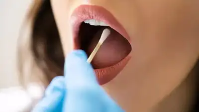  Oral microbes linked to increased risk of the deadly disease; risk factors and prevention tips