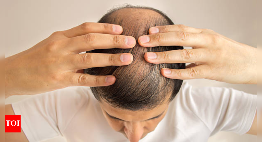 Science behind hair transplants: What you need to know before going under the knife