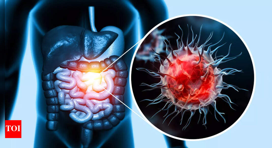 On a weight loss plan? Your diet may raise your colon cancer risk