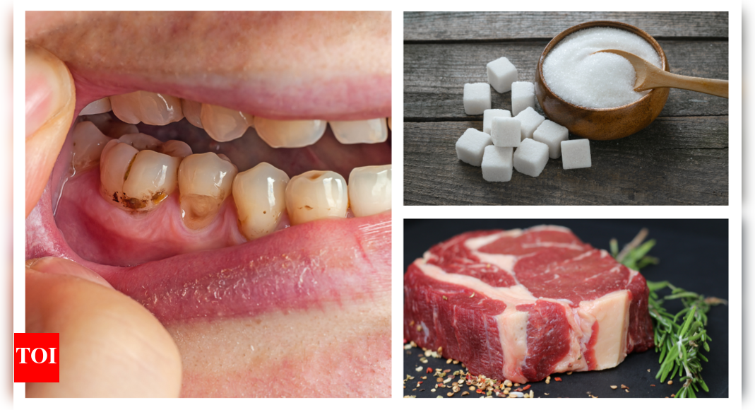 Excess of this food can cause tooth decay and impact dental health and no, it is not sugar