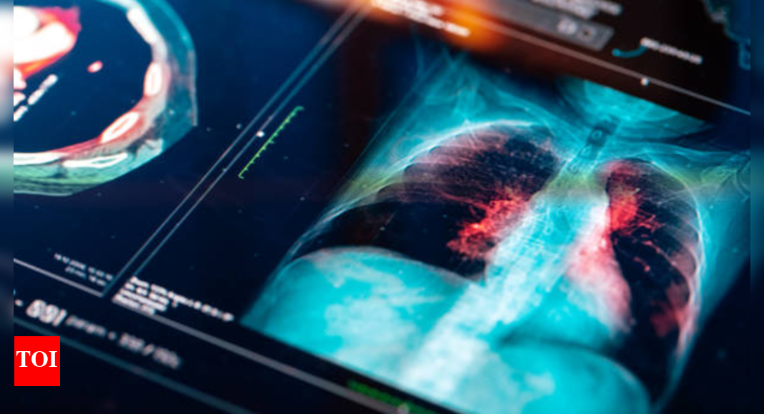 From smog to stress: Lifestyle factors that damage the lungs
