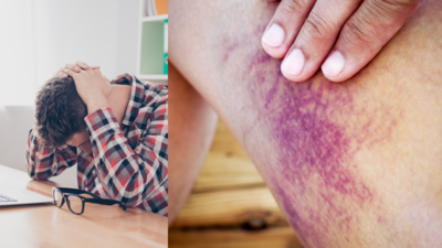 From persistent migraine to easy bruising: 6 signs that something is wrong with the body, and must not be ignored
