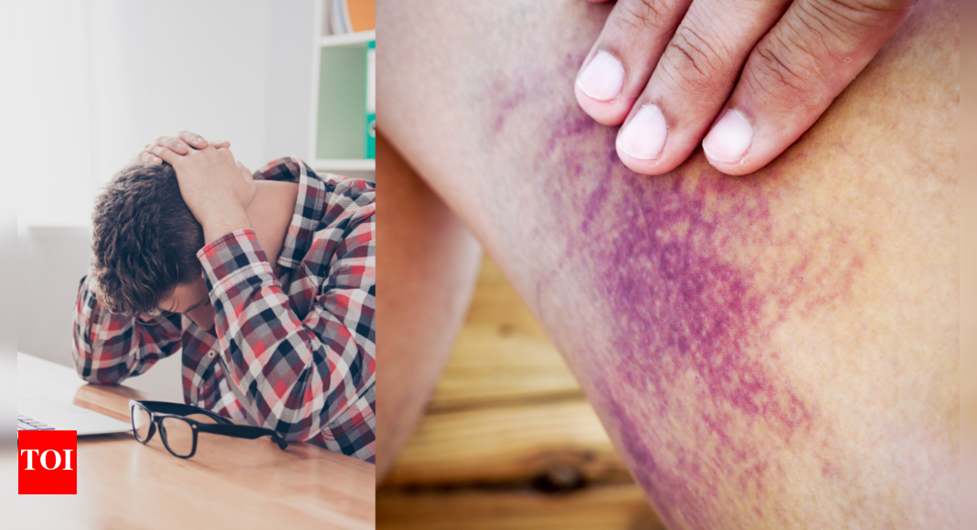 From persistent migraine to easy bruising: 6 signs that something is wrong with the body, and must not be ignored