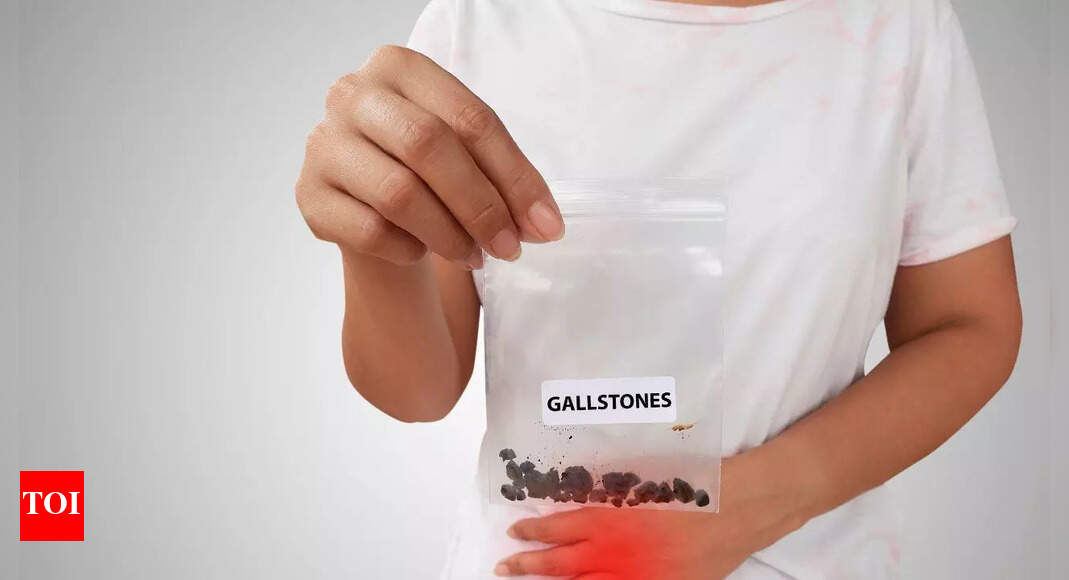 10 daily habits that could be raising your risk of gallstones