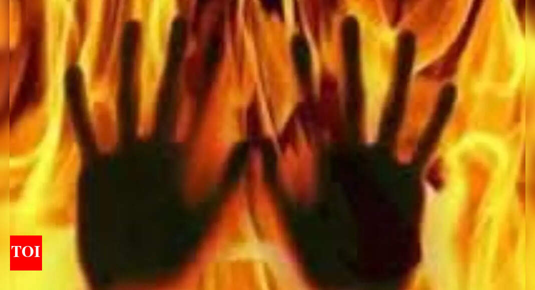 Dumper driver burnt alive in collision on Kanpur-Sagar highway