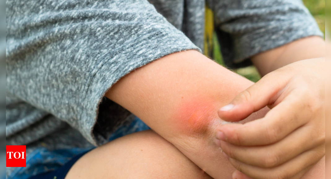 Protecting Children from Mosquito-Borne Illnesses: What Parents Should Know