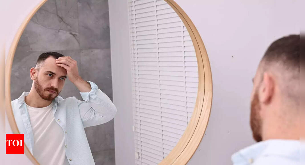 Is male pattern baldness a sign of fertility issues? Here’s what you need to know