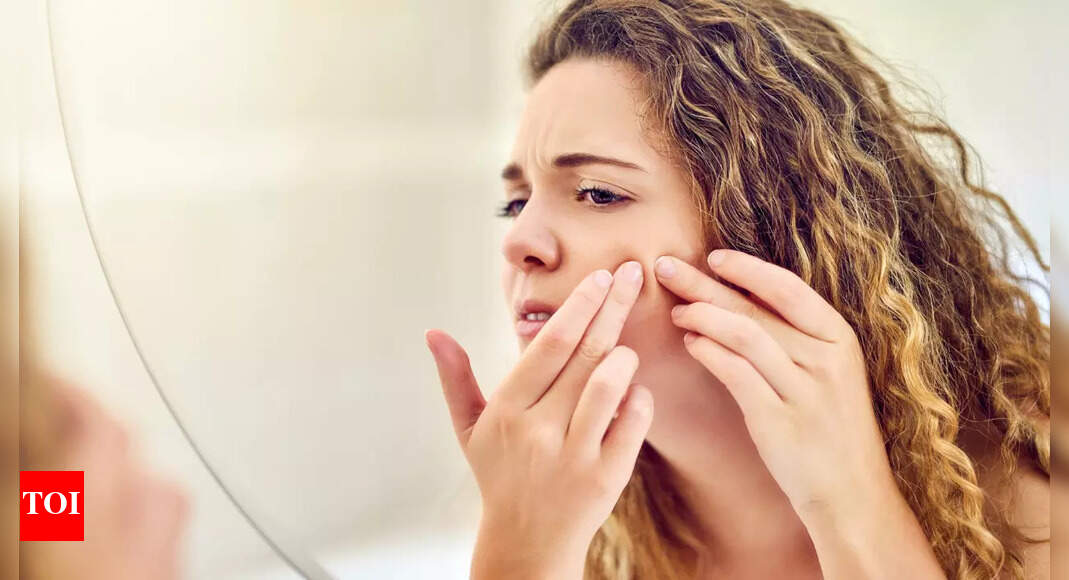 Popping a pimple in THIS area of the face can paralyze you, doc warns | – The Times of India