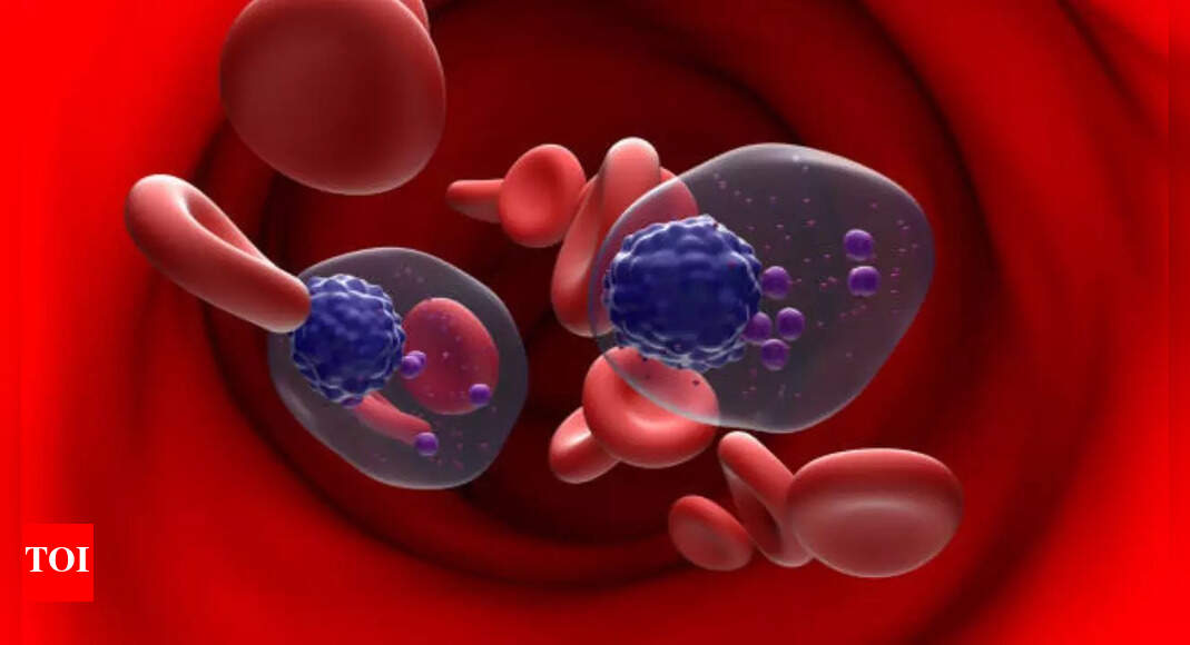 What is Myeloma? British woman diagnosed with a rare blood cancer that erodes bones
