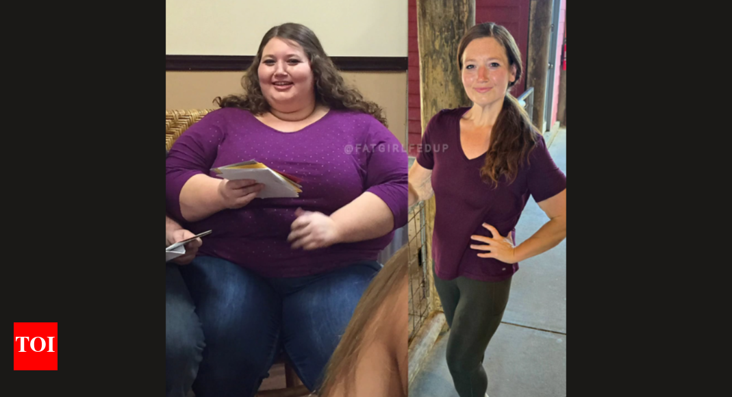 Weight loss story: Woman with rare disease, Calciphylaxis, sheds over 135 kilos; here’s her inspirational journey