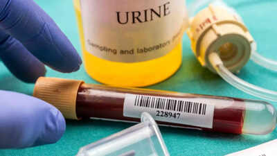 Understanding proteinuria: Kidney warning sign common in men with diabetes and high BP