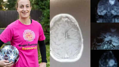 Fear of spiders or a brain tumor? The hidden warning signs that former soccer goalkeeper nearly unnoticed and her battle against cancer
