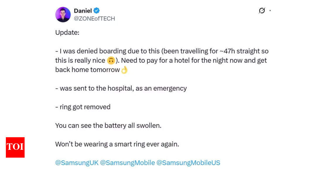 Influencer denied boarding after his smart ring swell, had to go to hospital instead: “Won’t wear ever again”