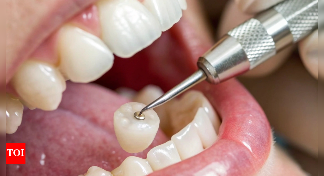 What exactly happens in a tooth implant? 5 things to know
