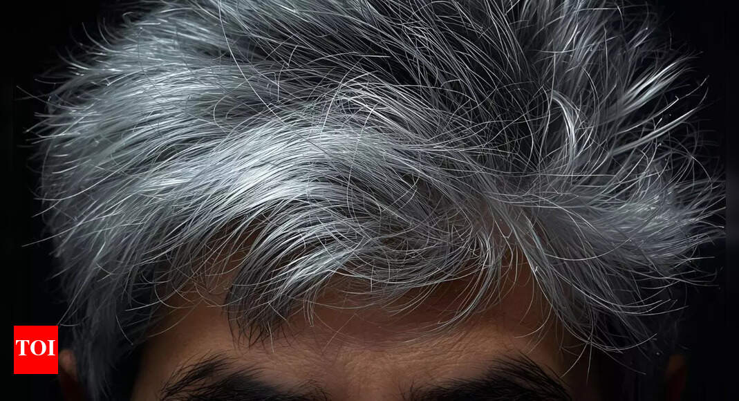 Your grey hair might be a warning sign of this vitamin deficiency