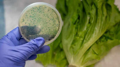 6 kitchen mistakes that could expose you to harmful E. coli and cause serious infections