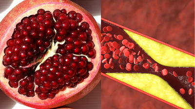 Is pomegranate juice a "magic cure" for artery blockages? Science reveals the facts