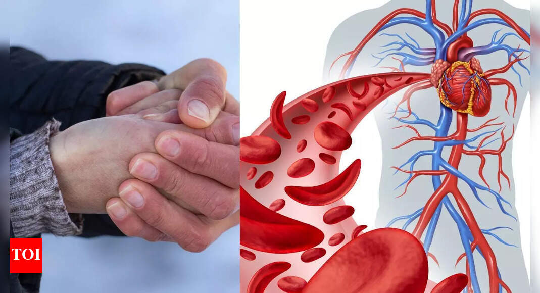 Cold hands and feet could be a serious warning sign: Know why your circulation is weak and how to fix it naturally