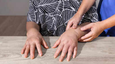 What causes swelling in fingers: Know 8 common reasons behind it