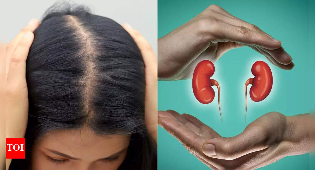 Hair loss as an early warning sign of kidney disease: Know its causes and types