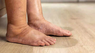 5 foot problems that could signal serious health issues