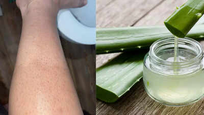 Home remedies for strawberry legs: How to smooth and care for your skin naturally