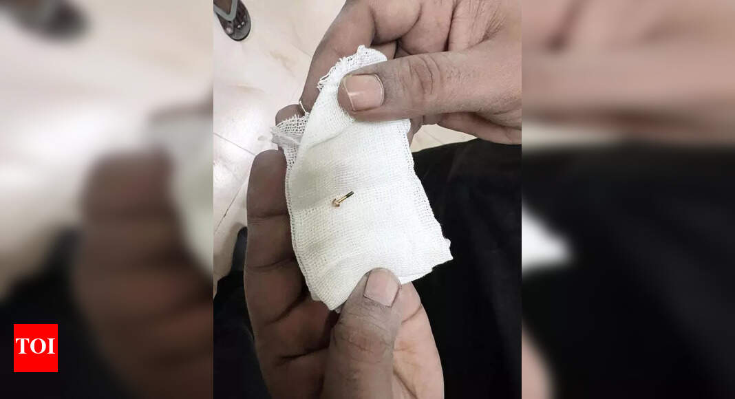Doctors at ICH remove nose stud from 10-month-old child’s lung