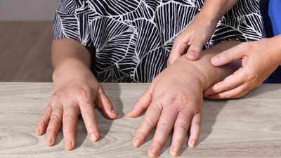 Common causes and treatment options for oedema